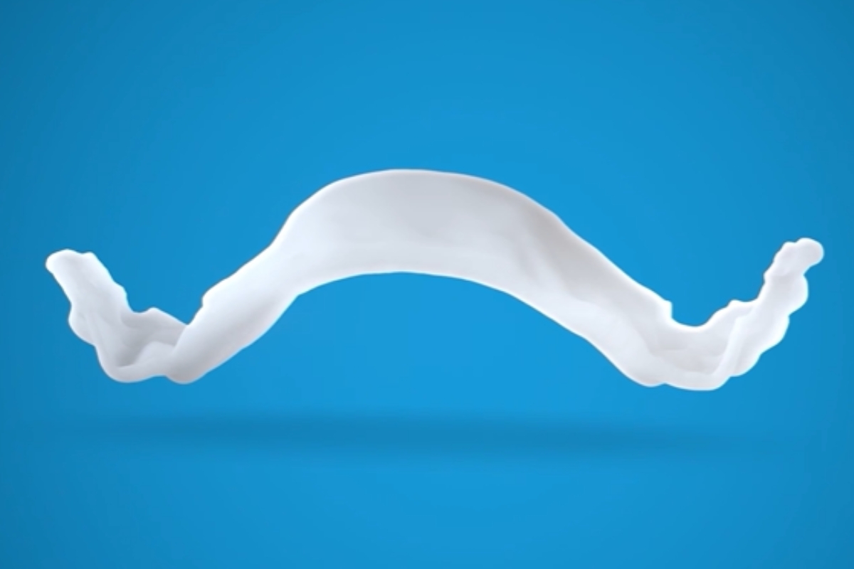 Invisalign Palatal expander