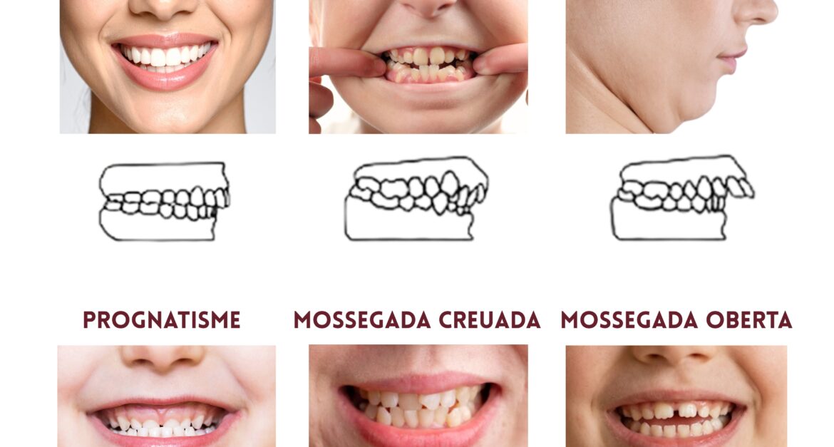 Oclusió dental per què és important controlar com encaixen les teves dents (1)